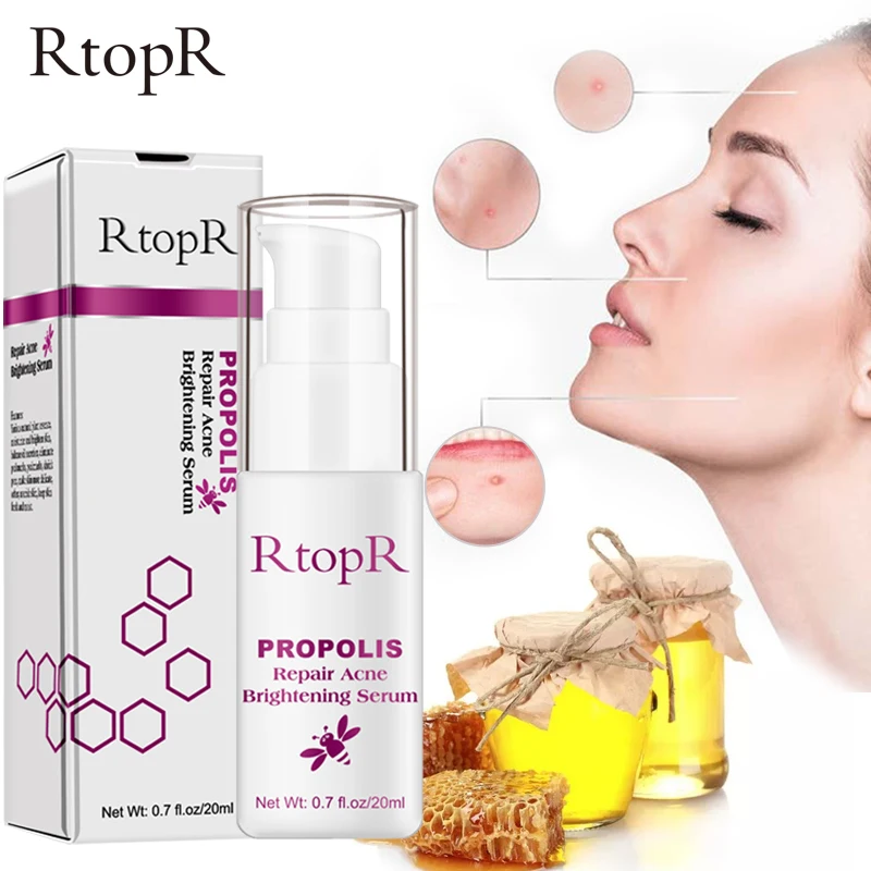 

RtopR Propolis Acne Spots Repair Face Serum Brighten Moisturize Skin Essence Shrink Pore Eliminates Scar Oil Control Treatment
