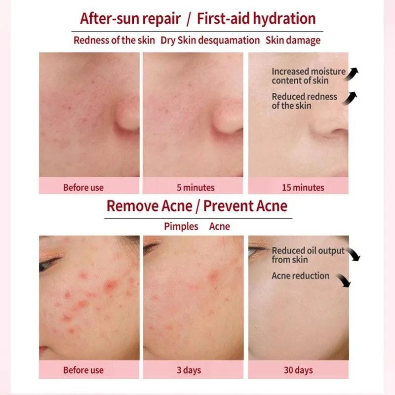 

40g Pink Aloe Vera Gel Essence Moisturizing After-sun Marks Acne Care Repair Aloe Gel Remove Acne Fades Skin Vera W0D1