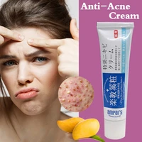 anti acne cream treatment cream blackhead acne cream repair gel oil control shrink pores scar facial care whitening skin 30g
