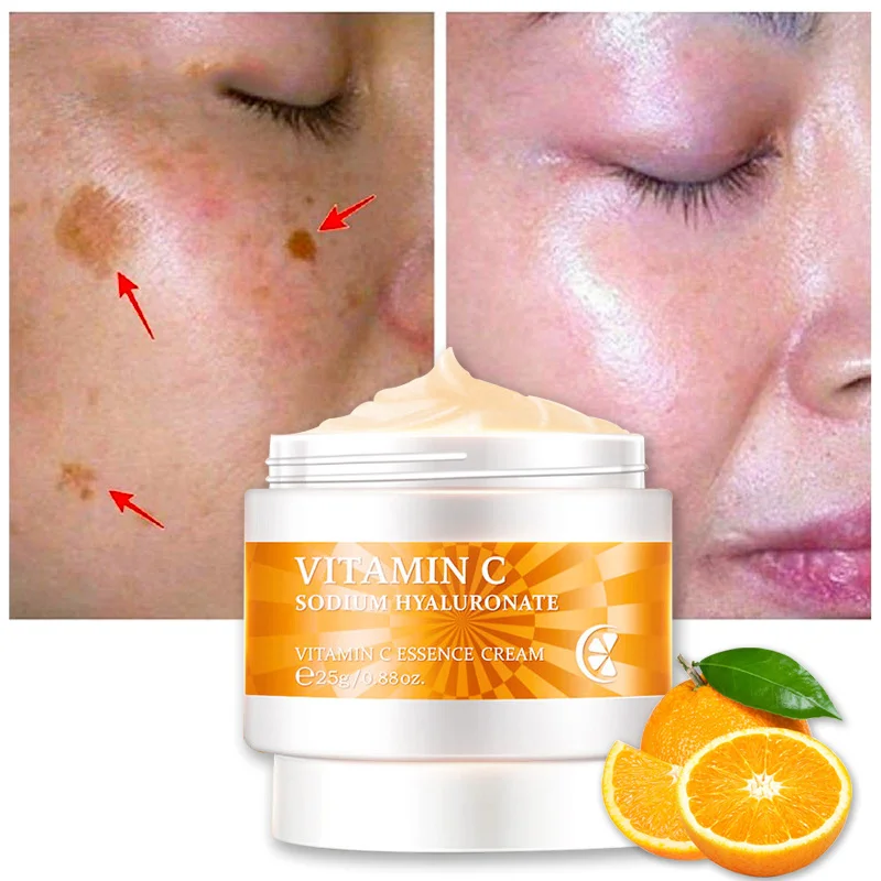 

Vitamin C Freckle Face Cream Remove Dark Spots Melanin Fade Freckles Brighten Whitening Fades Fine Line Shrink Pores Skin Care