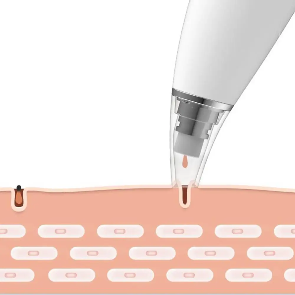 Устройство для удаления черных точек на лице