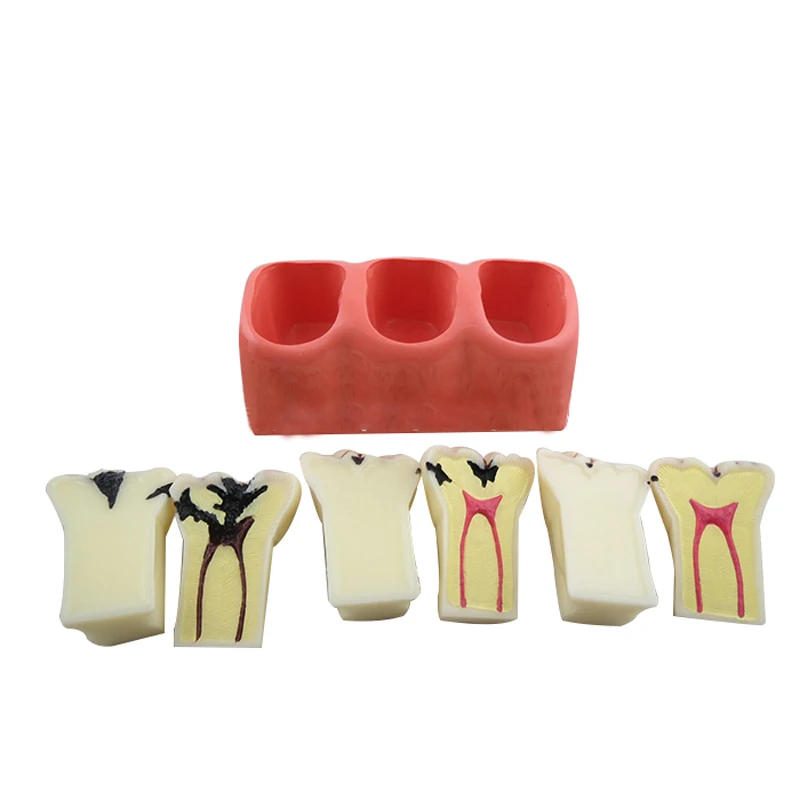 4х увеличенные Ортодонтические Брекеты для ухода за полостью рта новая модель