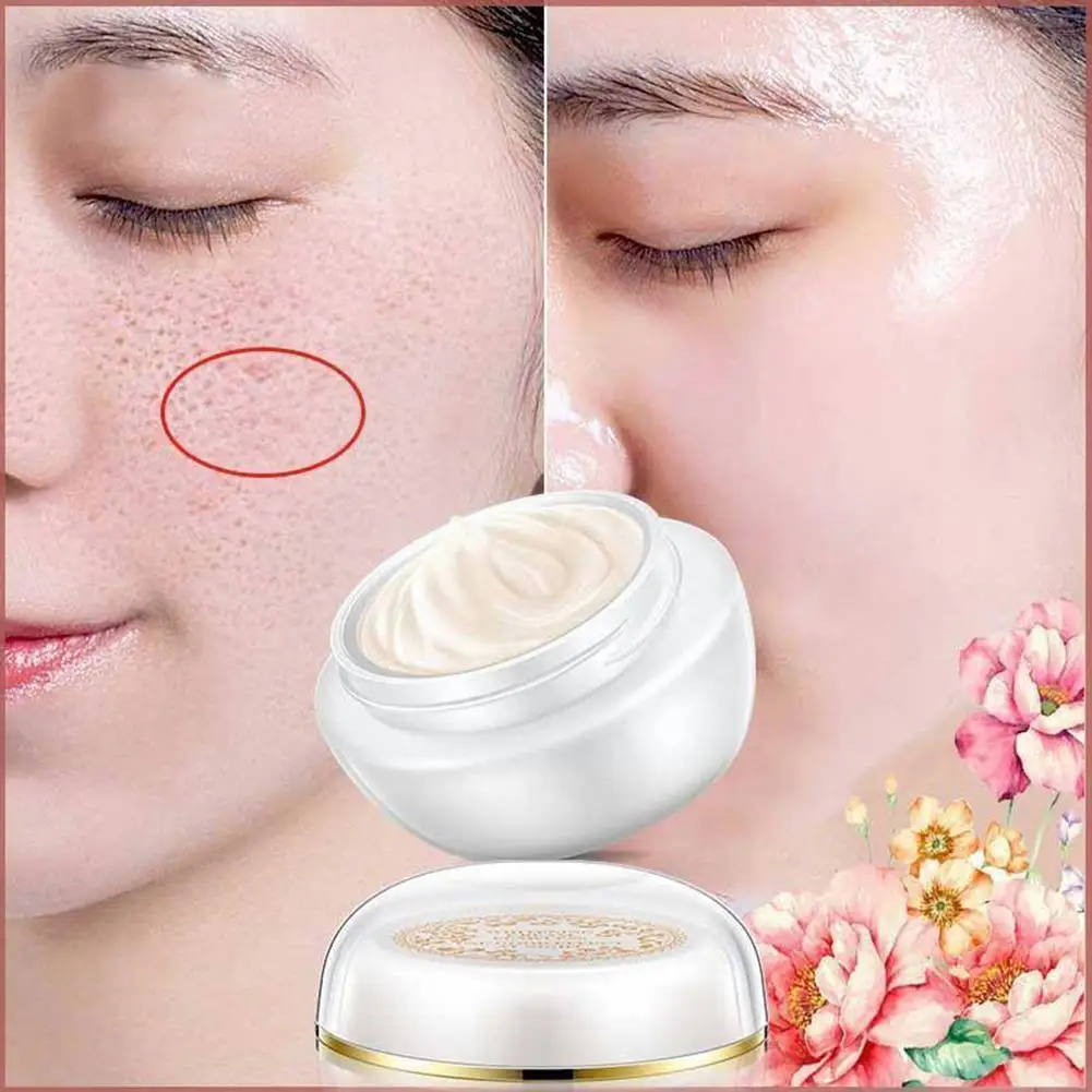 

Lady Skin Cream Freckles Sunburn Plaques of Pregnancy Glow Face Removal Permanent Remove Brighten Freckle Whitening Cream J4Q6