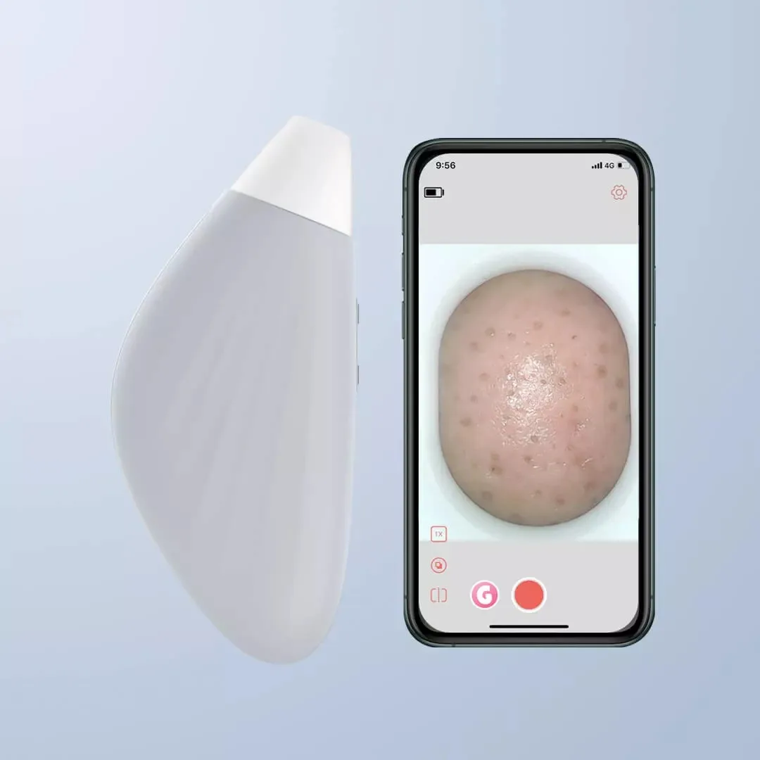 

NEW Xiaomi Youpin Smart Visual Blackhead Absorber-62Kpa Strong Suction 10 Times Magnification To Clean And Not Hurt The Skin