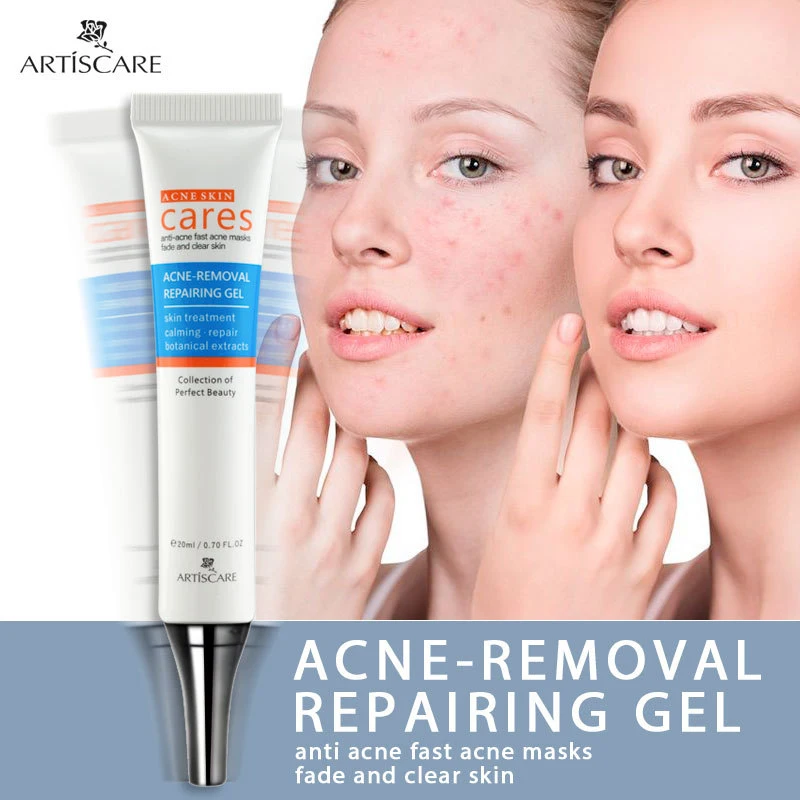 

Anti-acne Gel Water-oil Balance Moisturizing Deeply Repair Skin Acne Cream Skin Care Serum Blemish Cream Beauty Cosmetic TSLM1