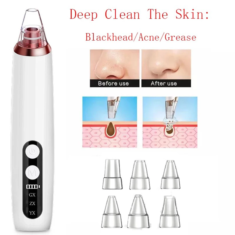 Инструмент для удаления угрей Электрический вакуумный удалитель носа лица