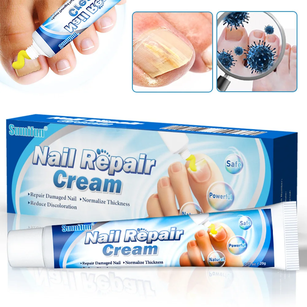 

1pcs Fungal Nail Repair Cream Care Treatment Foot Nail Fungus Removal Ointment Anti Paronychia Onychomycosis Plaster 20g