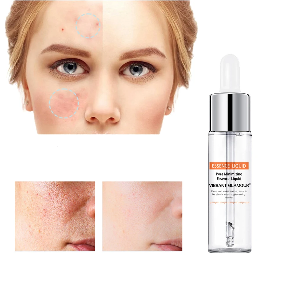 

Эссенция салициловой кислоты 15 мл, жидкая увлажняющая эссенция для удаления черных точек, уменьшение пор, отшелушивание, уход за кожей