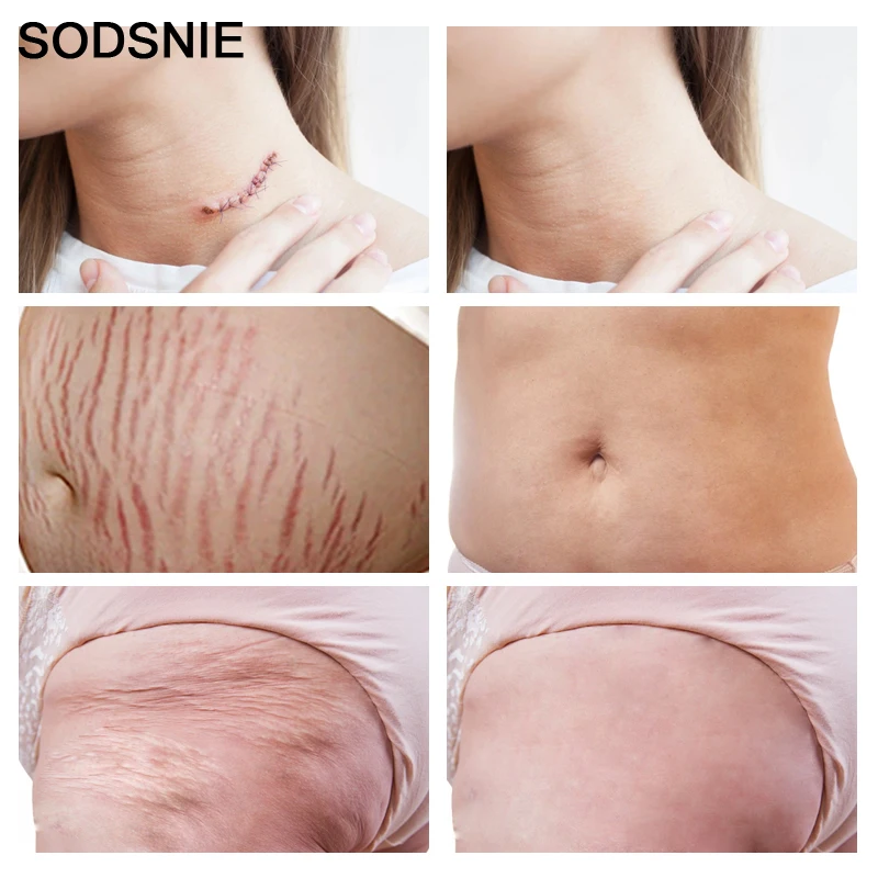 Натуральное масло для лечения кожи беременных женщин и кормящих матерей