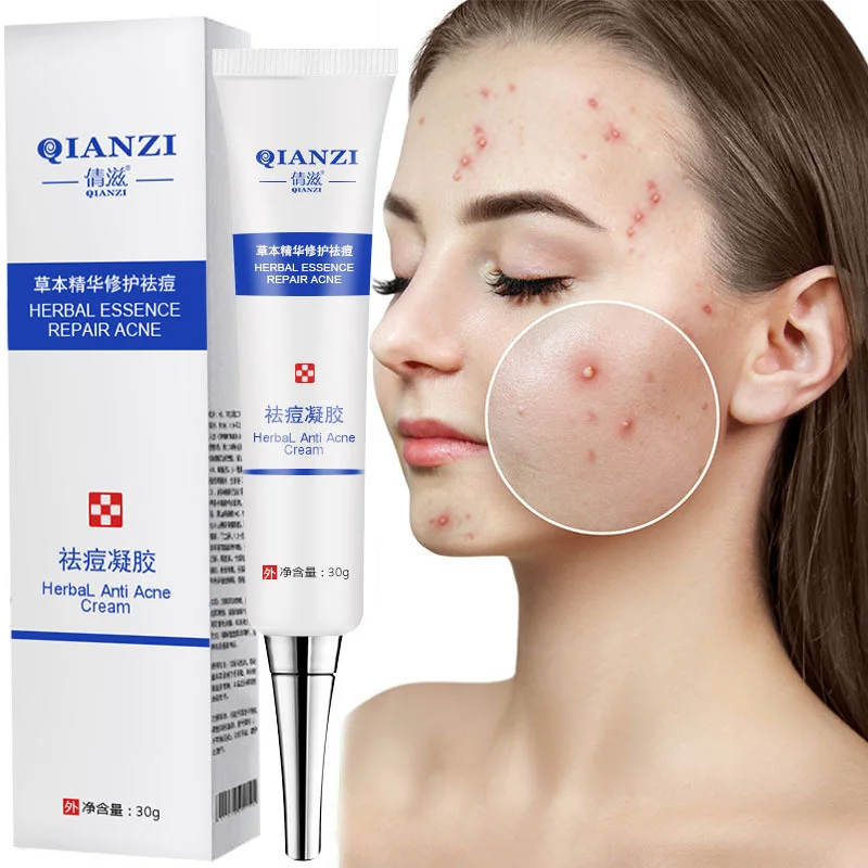 

Крем для удаления акне, лечение акне, восстановление черных точек, контроль жирности, Уменьшение шрамов, отбеливание, увлажнение, уход за ко...