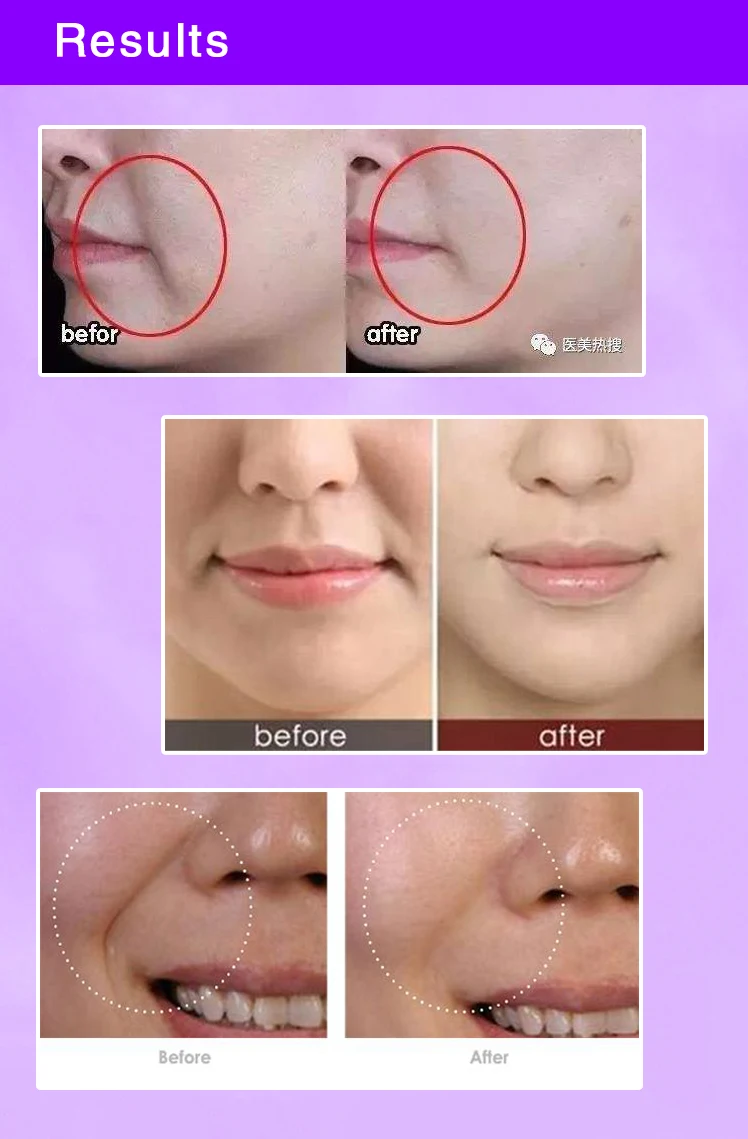 Бесплатная доставка отбеливающий патч для чистых пятен 5 листов лечение рубцов