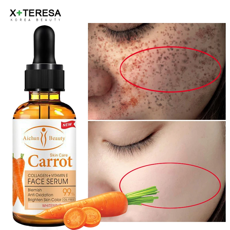 

Dark Spot Corrector Whitening Serum Face Bleaching Serum Brighten Blemish Freckle Remover Natural Carrot Essence Korea Skin Care
