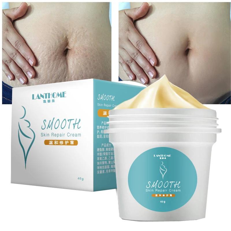 Крем для гладкой кожи удаления жирных морщин и растяжек| |