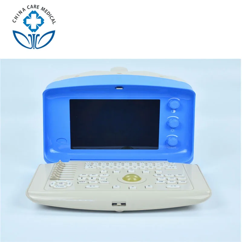 

Sonography Machine Portable Ultrasound Price