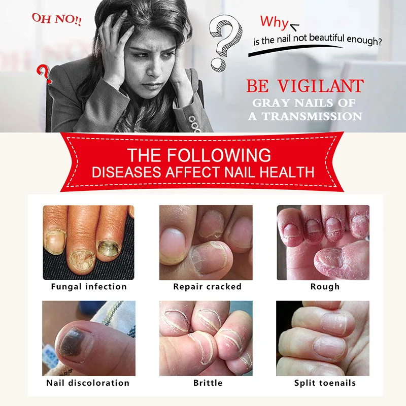 Масло для кутикулы 30 мл травяная эссенция лечения Ногтей отбеливания ногтей