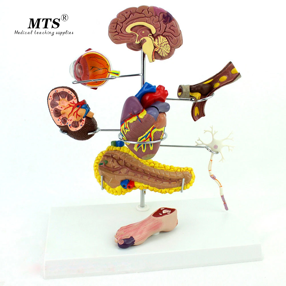 Аутентичная Медицинская медицинская модель для измерения диабета головы сердца