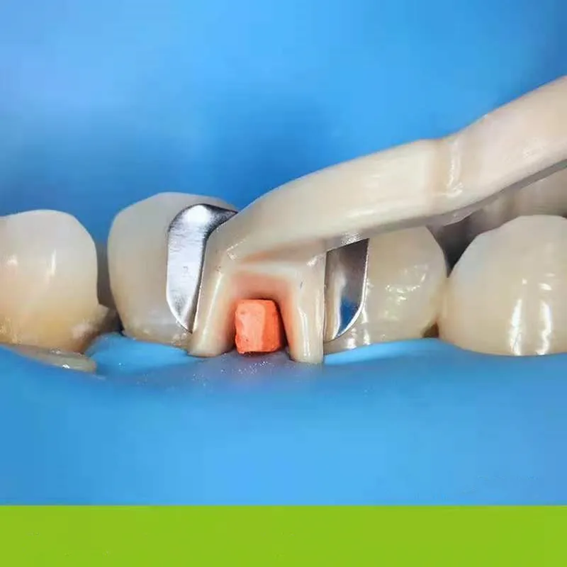 Полный комплект стоматологическая матрица секционные Контурные матрицы + 120 шт.