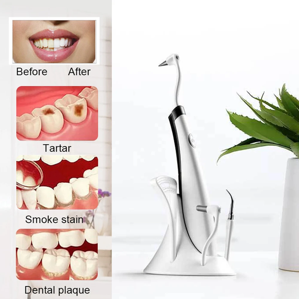 Стоматологический наконечник ультразвукового скалера Съемная ультразвуковой 5