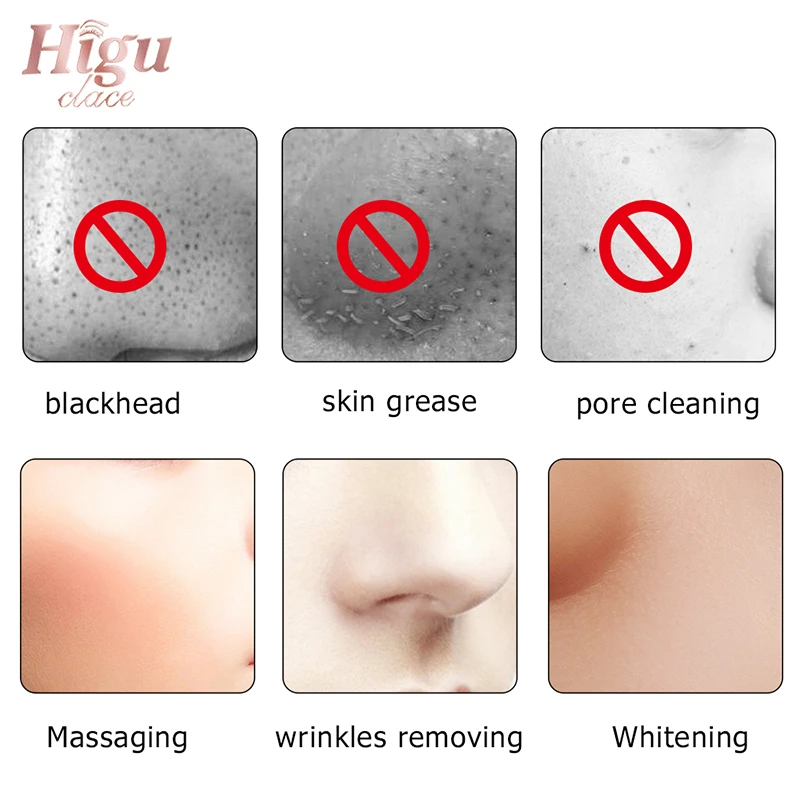 Скраб для кожи лица ультразвуковой очиститель Электрический инструмент спа акне