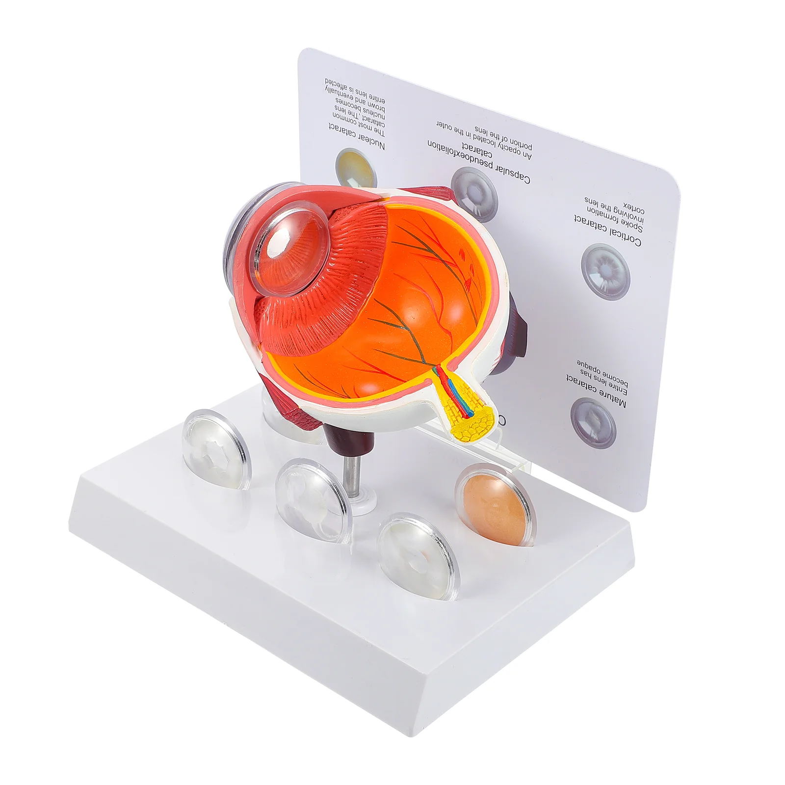 

Human Eyeball Model Cornea Eye Disease Model Pupil Eyeball Teaching Aids