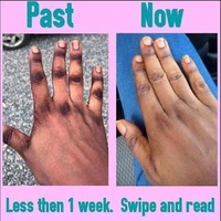 indian body scrub gel natural skin brightening lemon kojic acid scrub super whitening cream to remove darkness knuckles