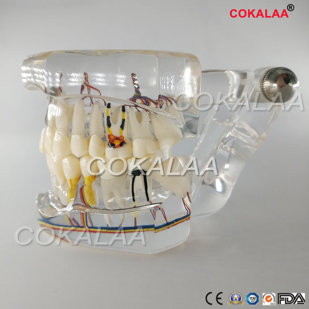 

Dental Restoration Teeth Model with Teeth Nerve Detachable Teeth Disease Teaching Model Transparent Implant Disease Teeth Model
