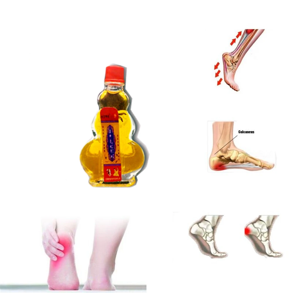 Остеопороз при радикулите Благодаря регулируемому положению Acesodyne эфирное масло