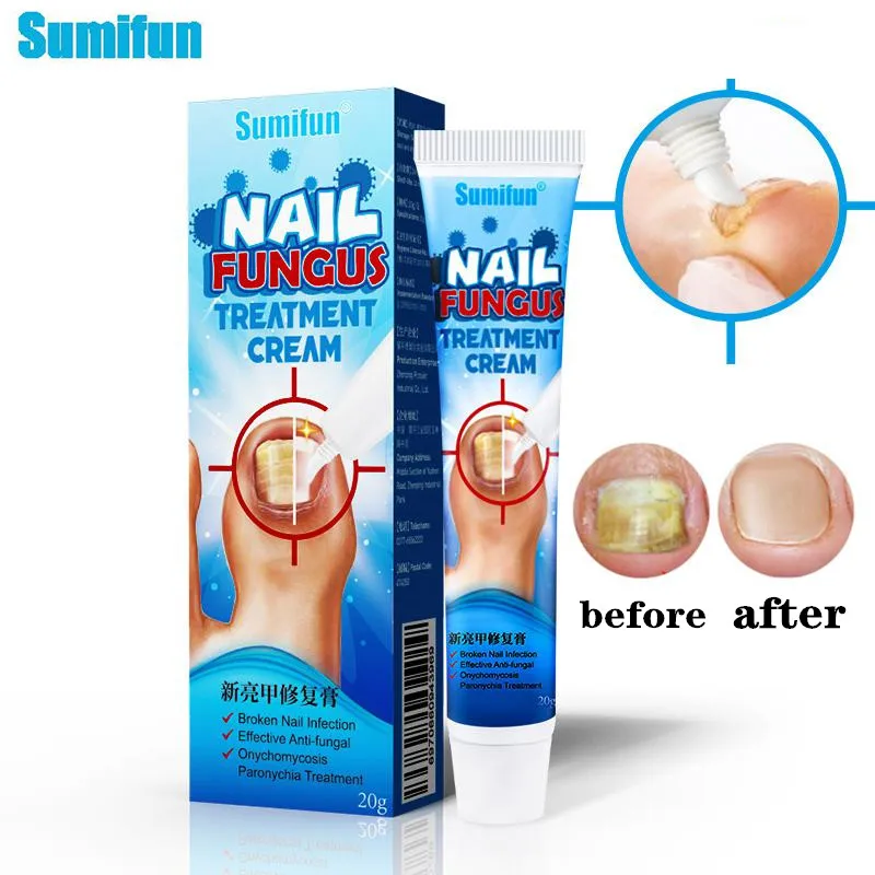 

Sumifun 20gNail Treatment Essential Ointment Remove Onychomycosis Fungus Paronychia Promote Nail Growth Anti Infection Nail Care