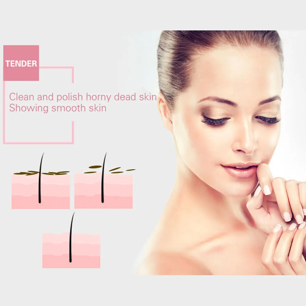 Уход за кожей угрей Удаление прыщей вакуумный всасывающий инструмент аппарат