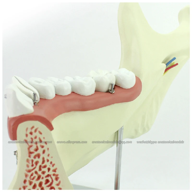 

12625 / Anatomic Model of Inferior Jaw Bone and Tooth Body, Medical Science Educational Teaching Anatomical Models