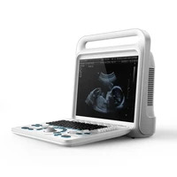 china supplier 15 inch lcd flat screen 4d full digital portable ultrasound scanner machine