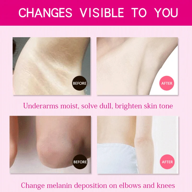 

Women Armpit Whitening Cream Underarm Private Part Nipple Skin Care Cream BUTT666