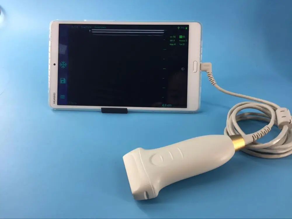 

2019 High Sensitive low price USB type C ultrasound b scan work well with cellphone