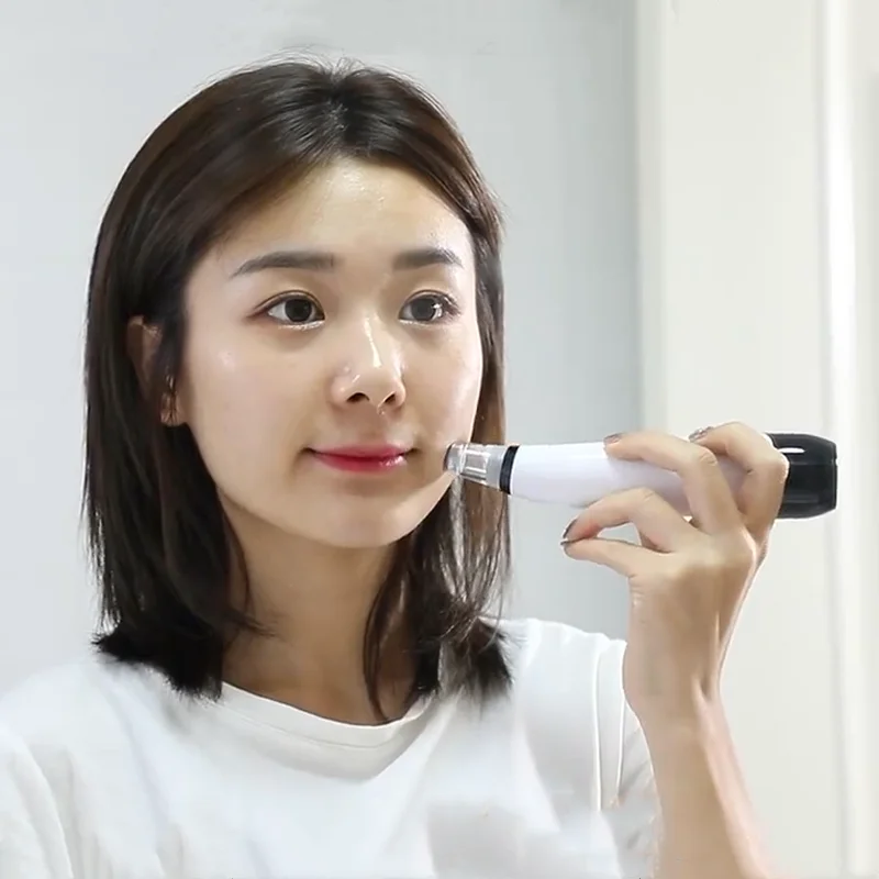 Прибор для удаления черных точек на лице 6