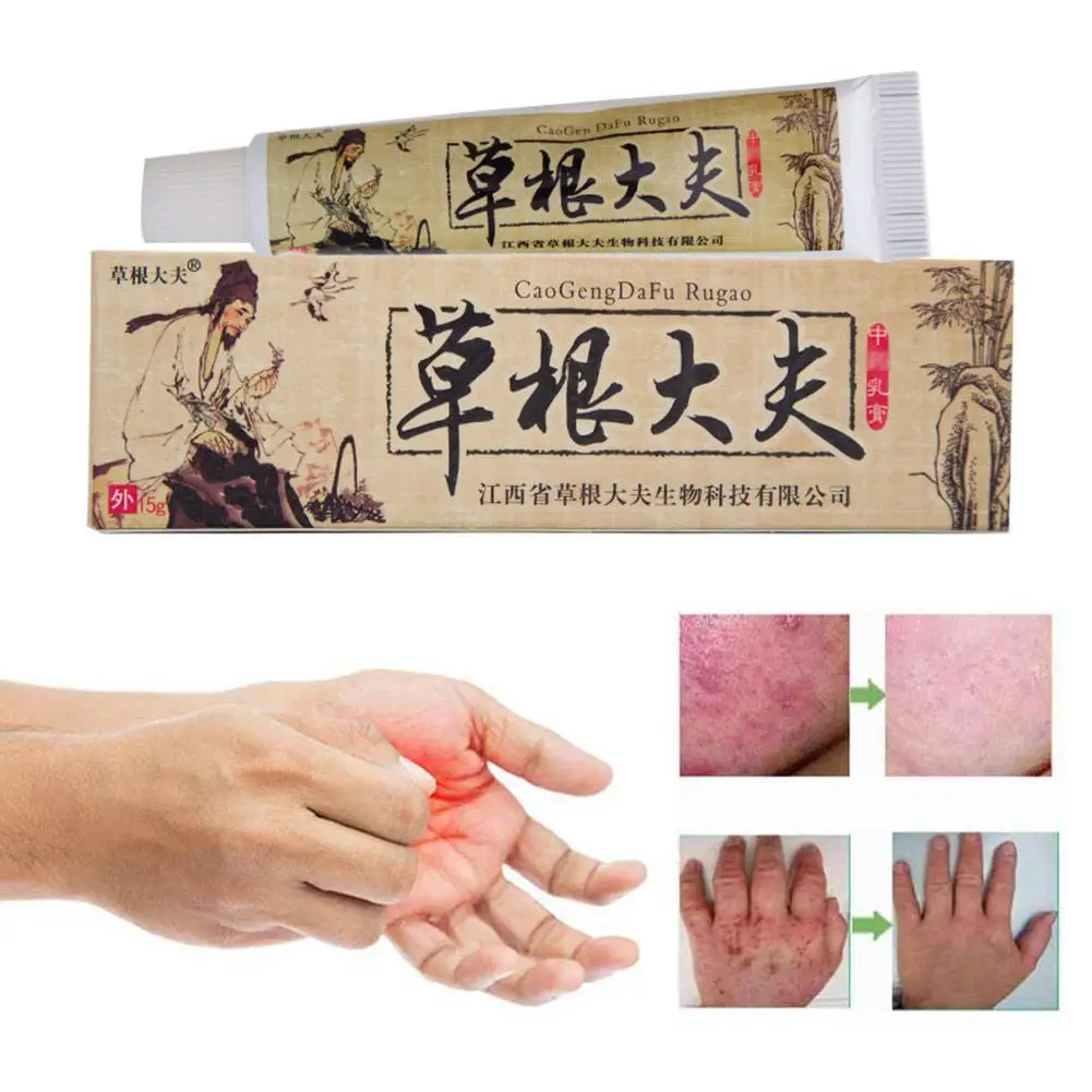 Китайский травяной крем от псориаза кожи зуд рельеф для тела Tinea versicolor Balanitis