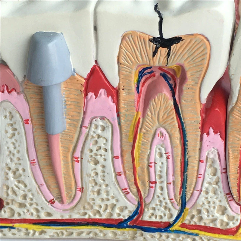 1 шт. анатомическая модель зубов | Красота и здоровье
