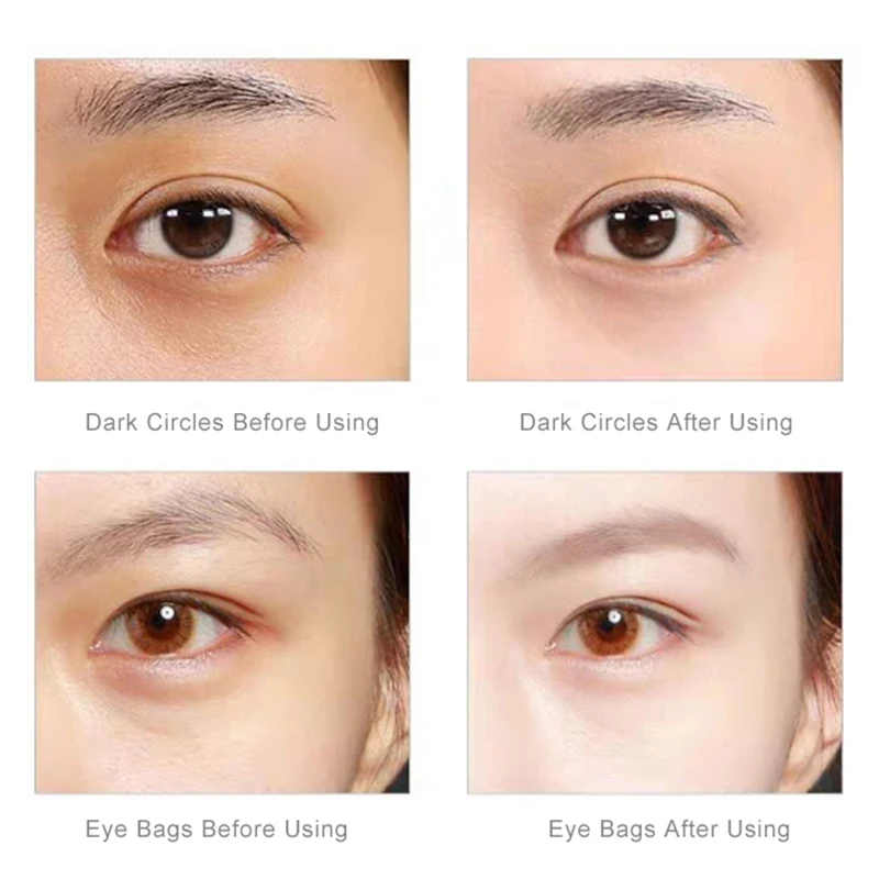 Nanotime Eyemagic beauty, ручка против морщин, мини устройство для массажа глаз, электрическая вибрация лица, волшебная палочка для ухода за кожей, инструмент для красоты