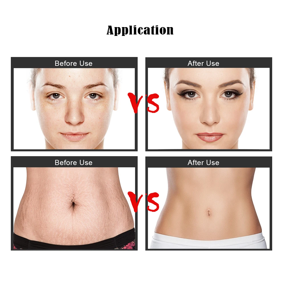 Biomaser Beauty машина для перманентного макияжа микроиглы ручка ухода за кожей 36 нано