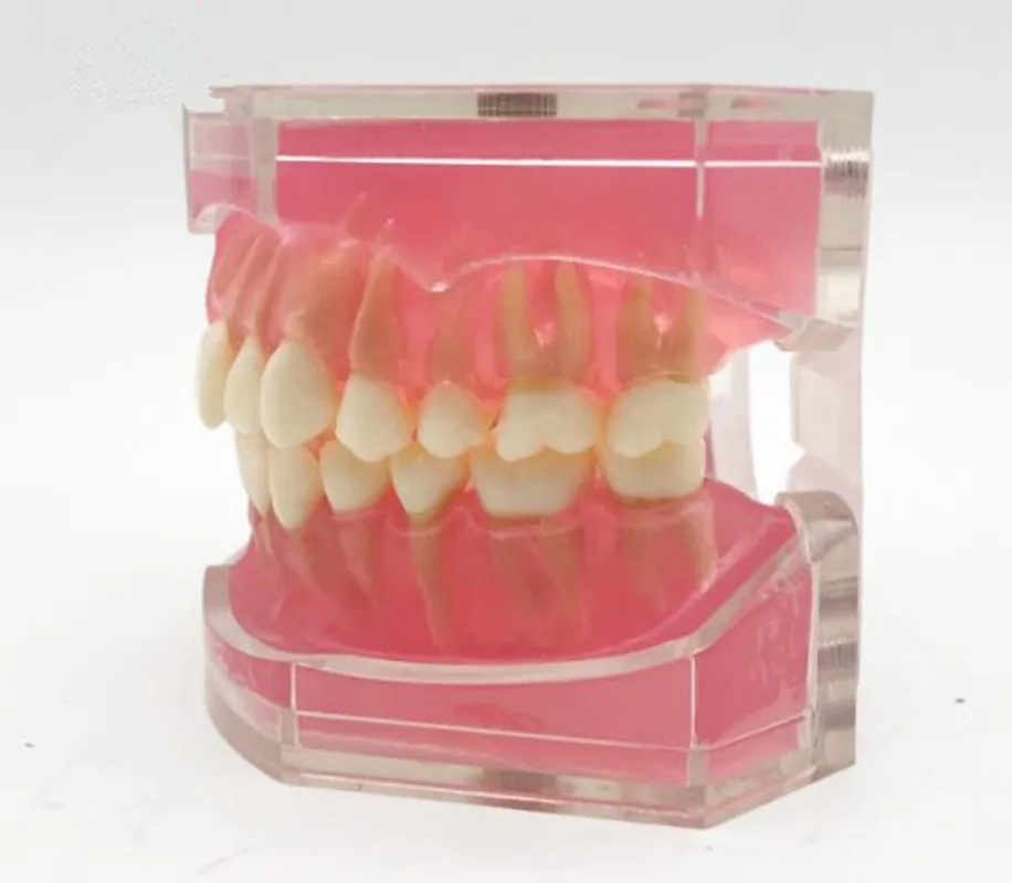 

Стоматологическая модель зубов учебное обучение стандартной модели с съемными зубы