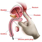 Катетер уретральный с электрическим разъемом для пениса, расширитель, взрослые секс-игрушки для мужчин, силиконовый 5 шт.лот, Мужской мастурбатор с электрошоком