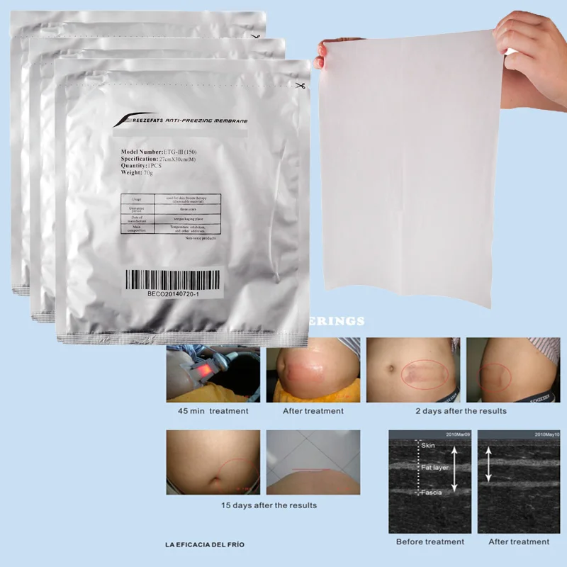 

5pcs 100% Effect New Arrival Lowest Price Anti freeze Membrane 27*30cm 34*42cm Antifreeze Membrane Cryo Pad for Cryolipolysis