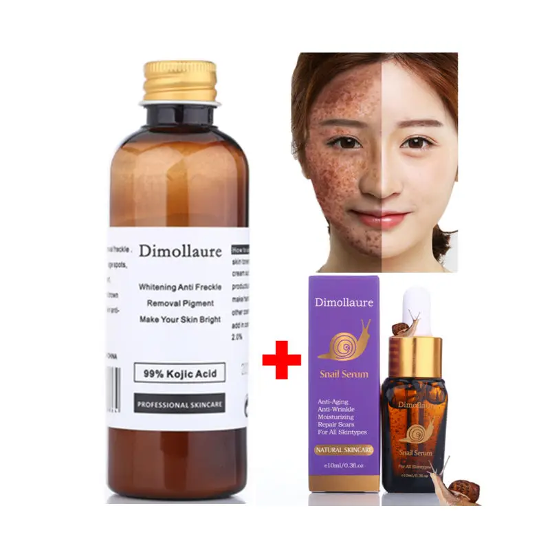 kojic acid-snail Dimollaure, 30 г, чистый отбеливающий крем с койевой кислотой+ витамин С, сыворотка для удаления прыщей, против старения, пигментов, меланин, крем от морщин - Цвет: kojic acid-snail