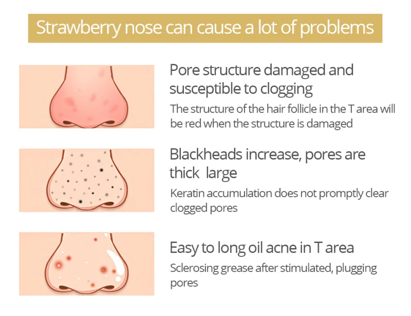 Маска для удаления черных точек Бамбуковая маска с древесным углем глубокой