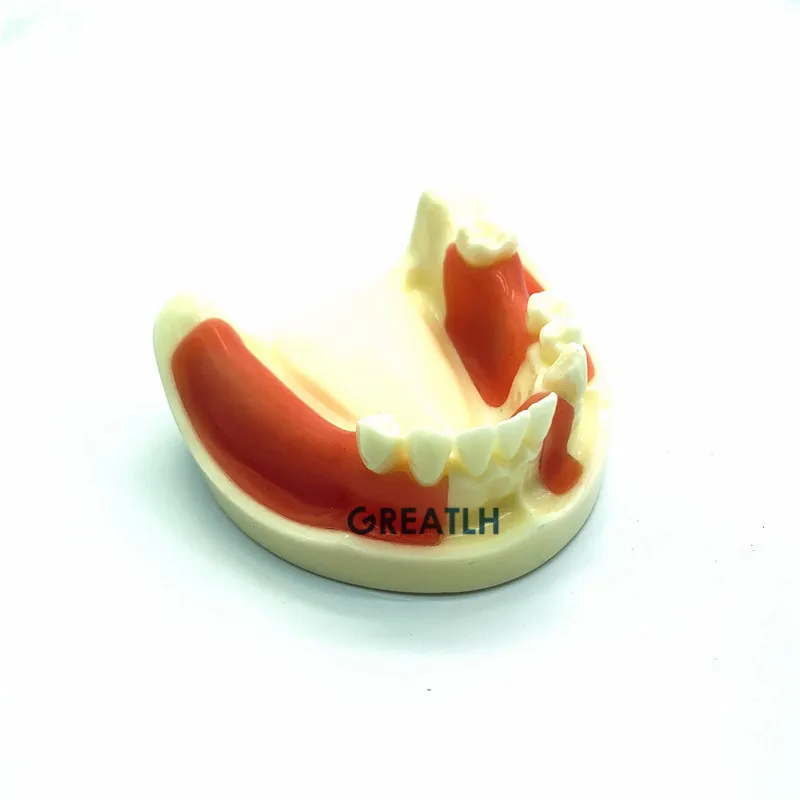 Стоматологическая нижняя челюсть Gingiva модель отсутствующие зубы