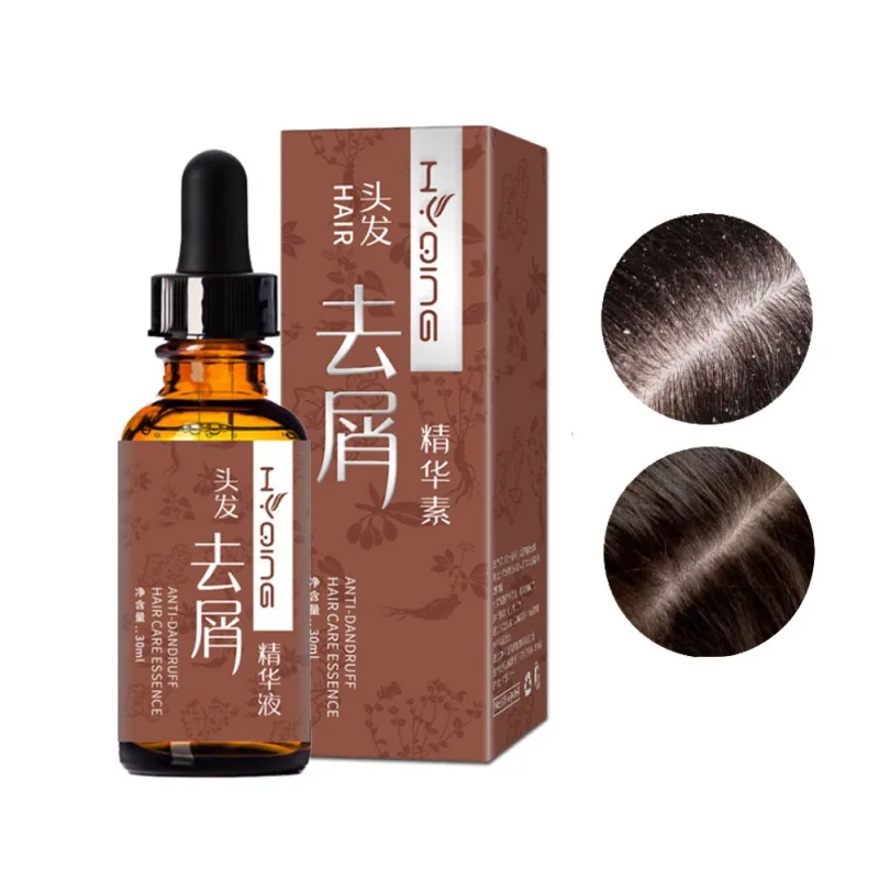 

30ml Hair Nourishing Repair Moisturizing Hair Essential Oil Hair Scalp Treatments Dandruff And Itch Removing Hair Essential Oil
