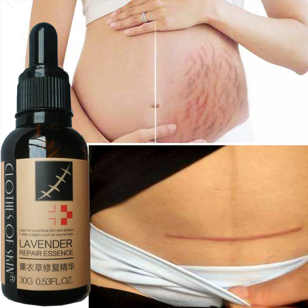 Лечение гладкой кожи восстановление эссенция для ухода за кожей лаванда дезальт