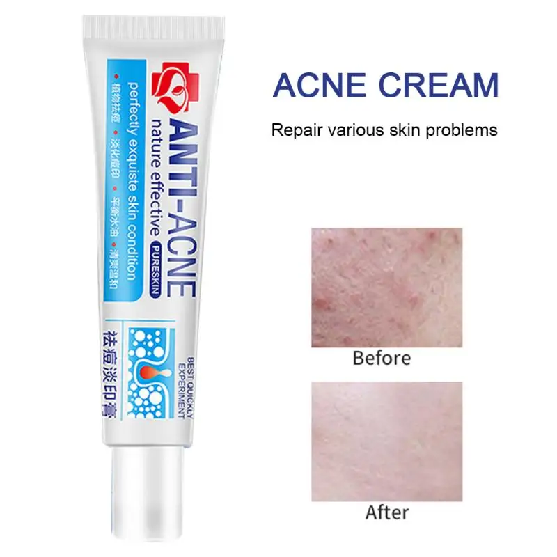 

Herbal Traditional Chinese Medicine Acne Treatment Shrink Pores Spots Gel Bleaching Creams Whitening Moisturizing Face Cream