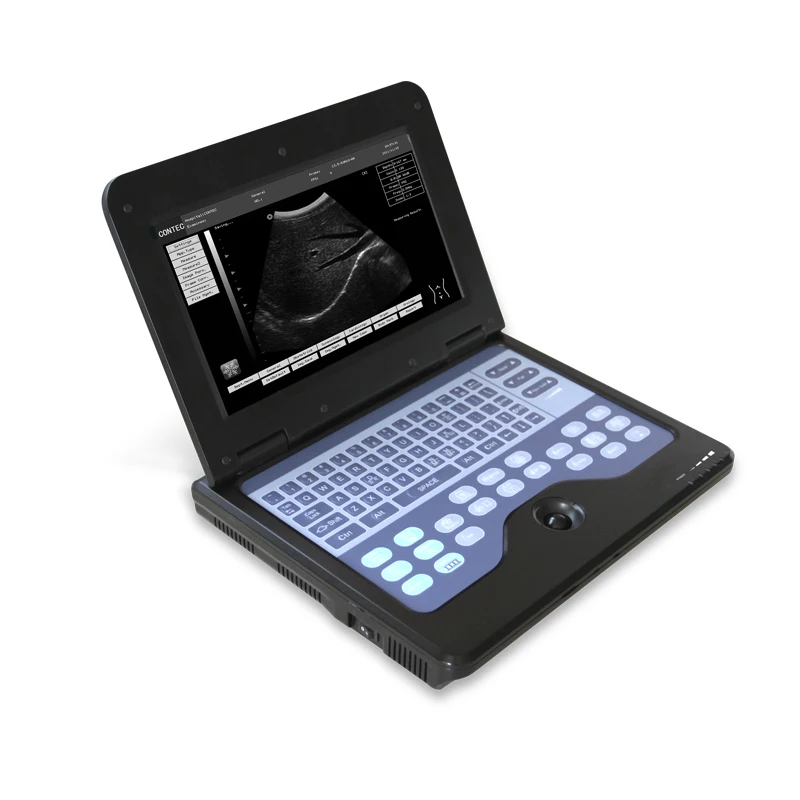 

Medical Cheap Price Notebook Laptop B-Ultrasound Diagnostic System ultrasound diagnostic apparatus Scanner B system Machine