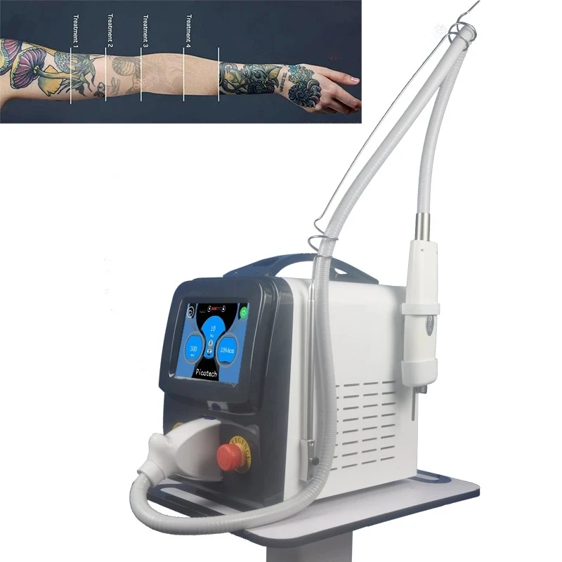 2022 Newest 1064nm 532nm 1320nm Nd Yag Laser Equipment Tattoo Removal Eyebrow Freckle Factory Sales For Salon PICO enlarge