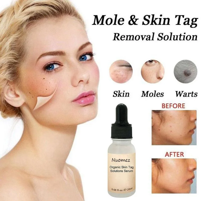 

Desalination And Repair Of Essential Oils Facial Mole Ointment Repair To Moles Moles And Anti-scars Essential Oil 20ml